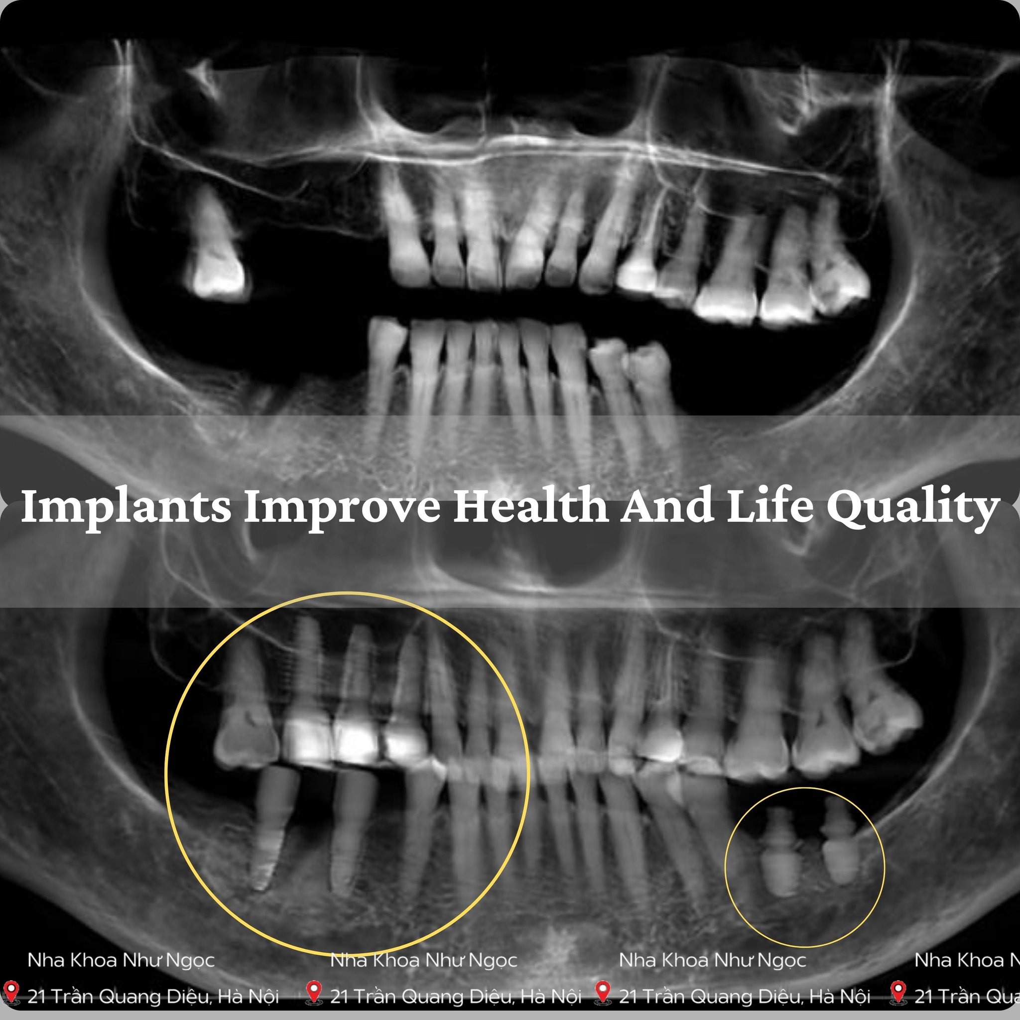Lập phác đồ điều trị