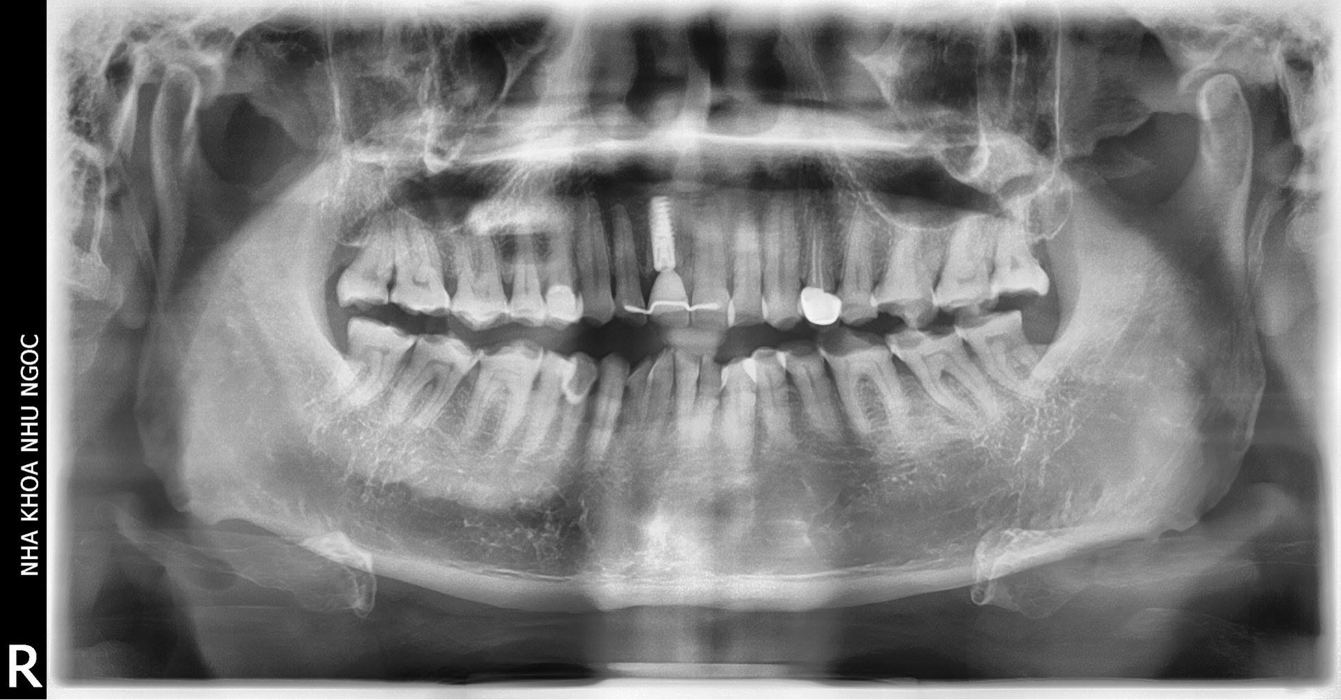 Lập kế hoạch điều trị cá nhân hóa