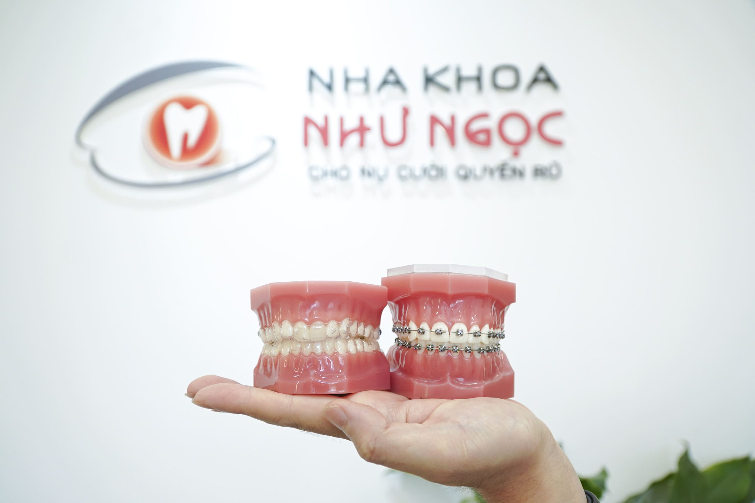 Lựa chọn khí cụ chỉnh nha