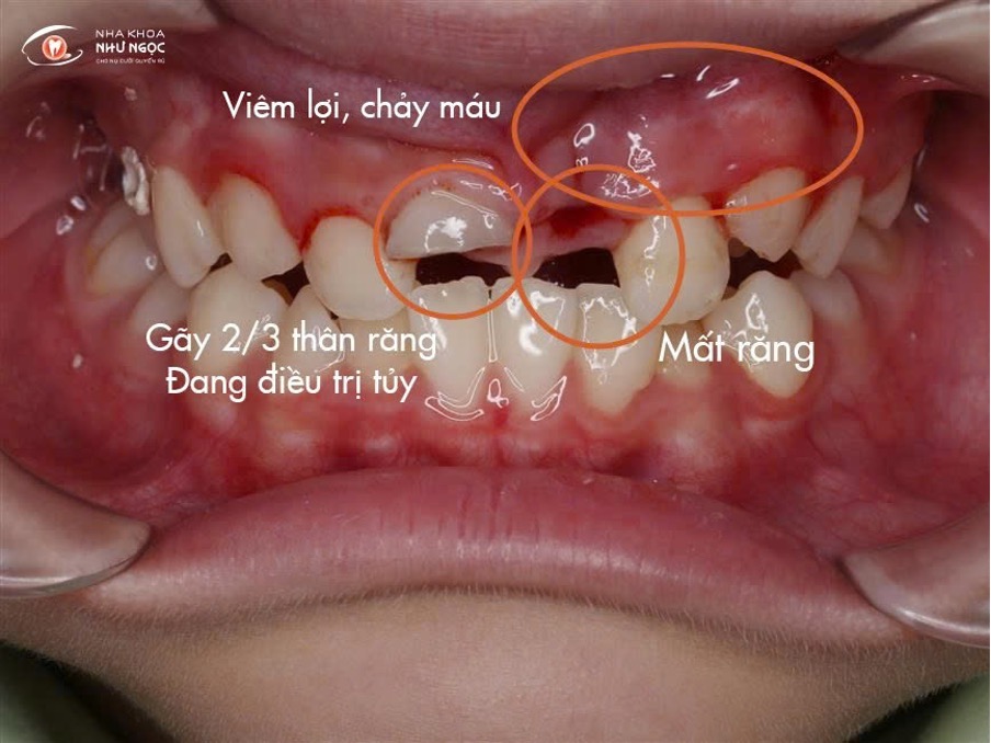 Nha khoa Như Ngọc 