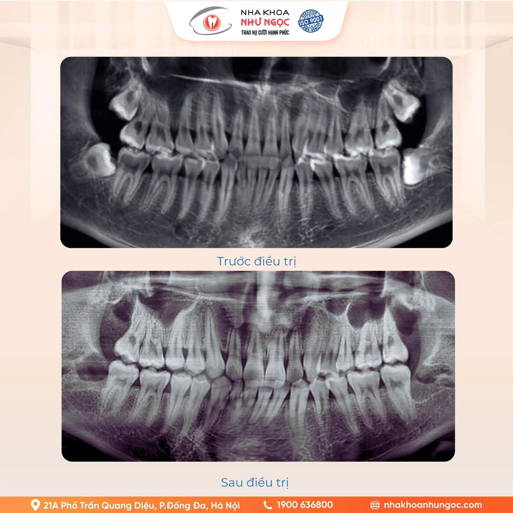Nha khoa như ngọc