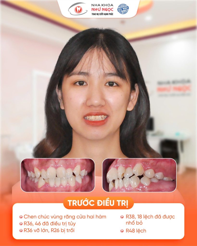 nha khoa Như Ngọc 