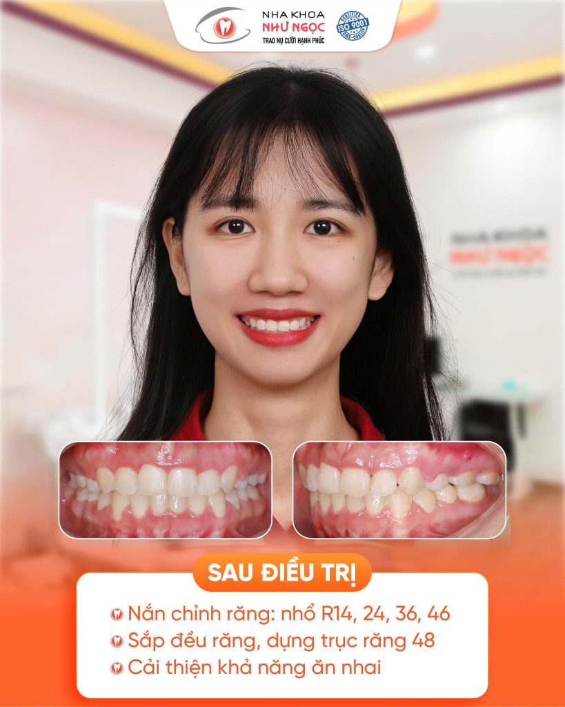 nha khoa Như Ngọc 