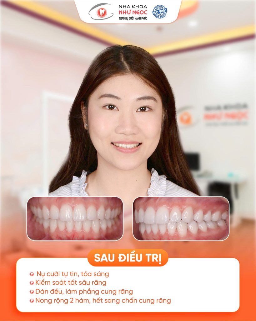 nha khoa Như Ngọc 