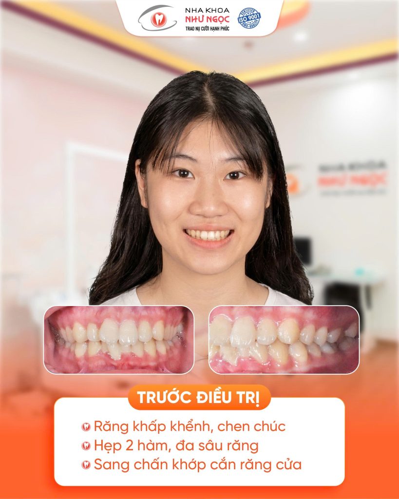 nha khoa Như Ngọc 