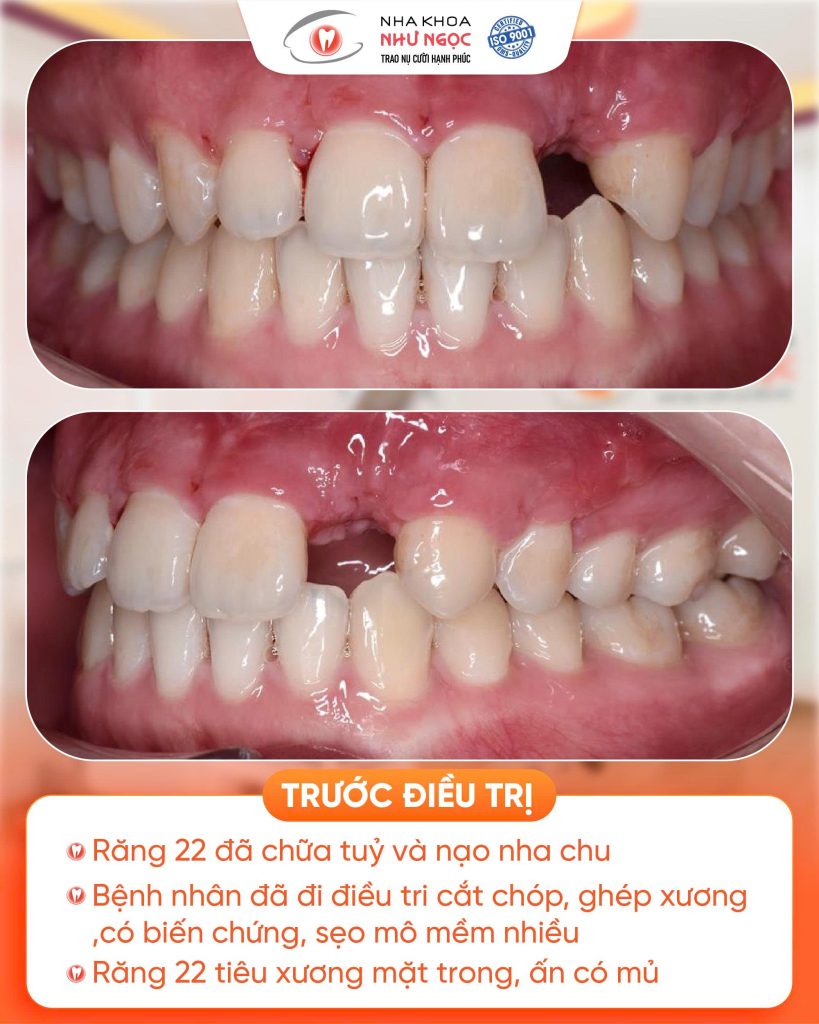 nha khoa Như Ngọc 