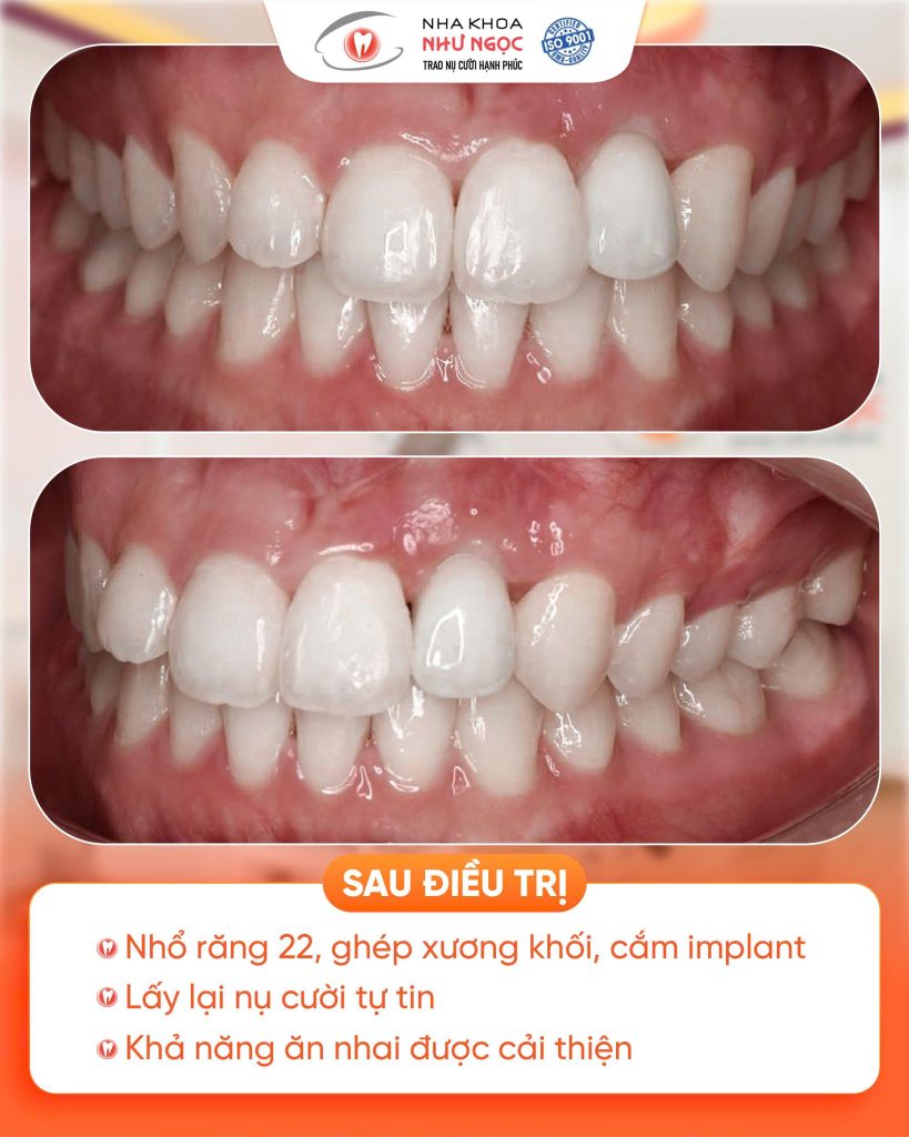nha khoa Như Ngọc 