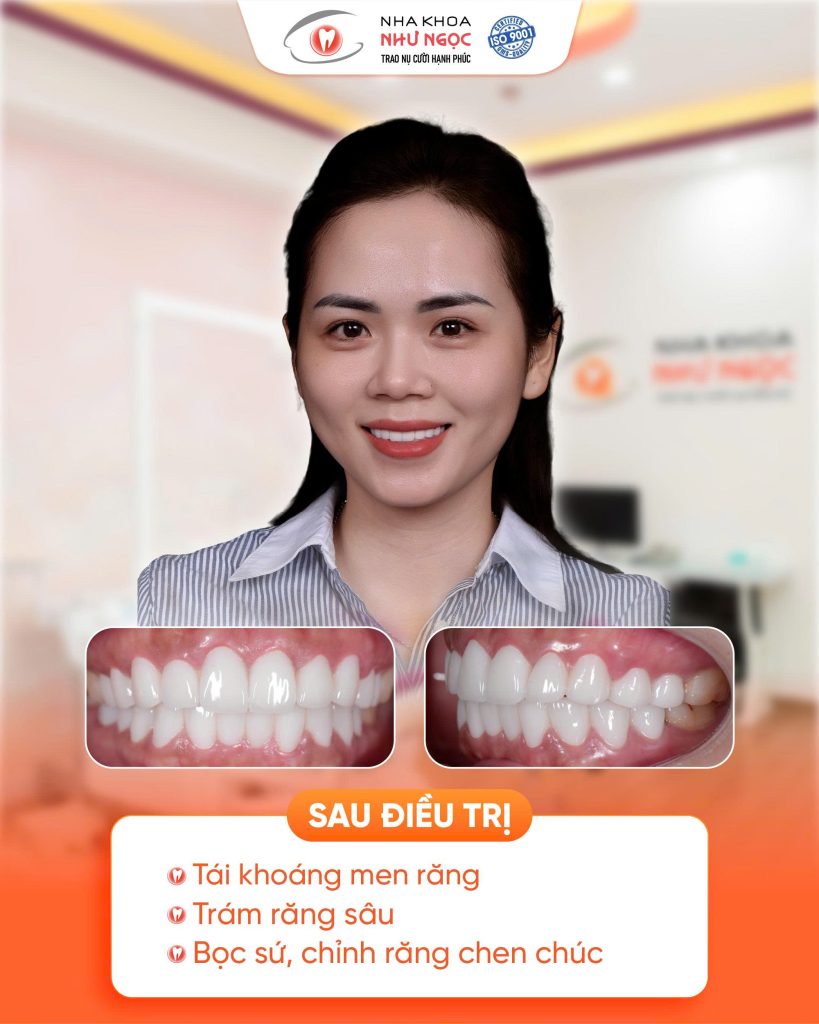 nha khoa Như Ngọc