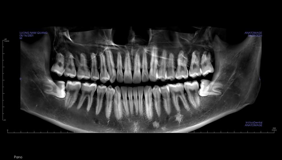 nha khoa Như Ngọc