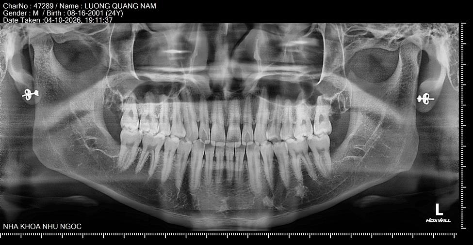 nha khoa Như Ngọc