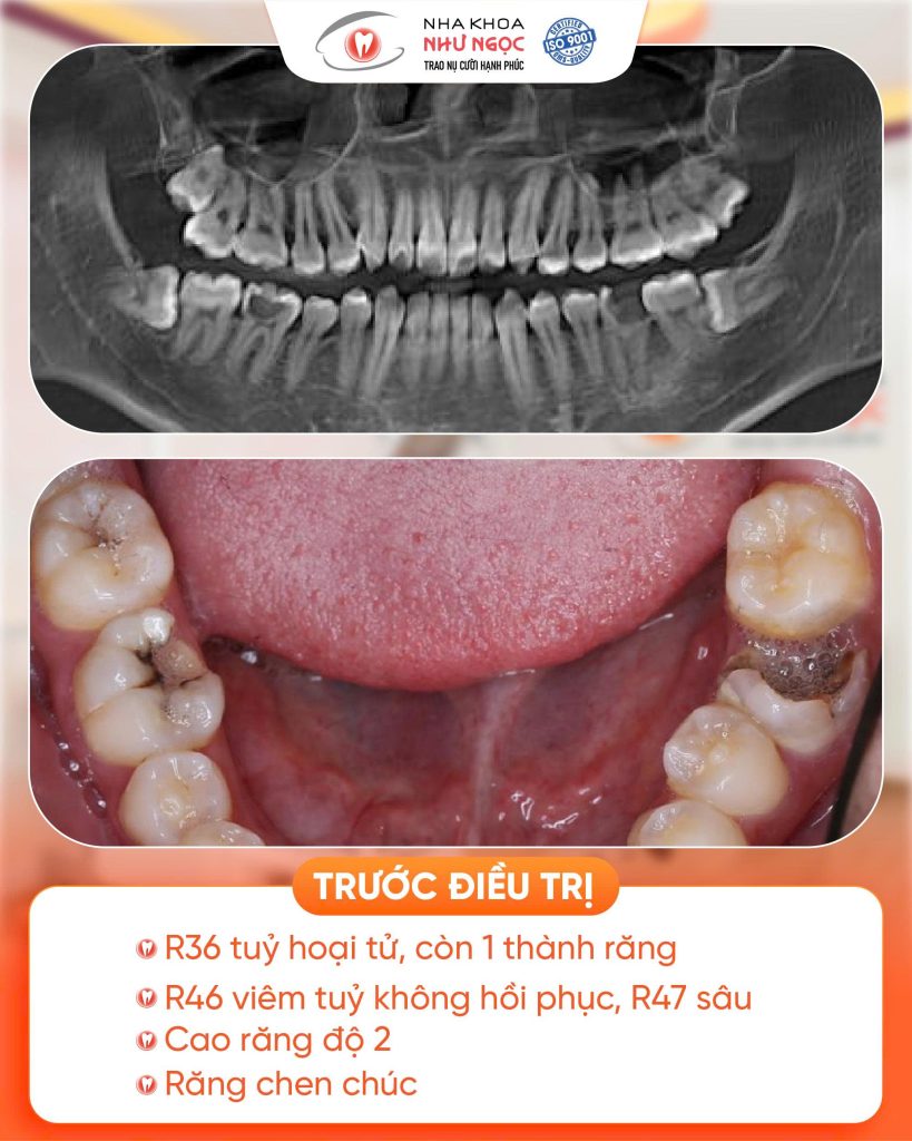 nha khoa Như Ngọc