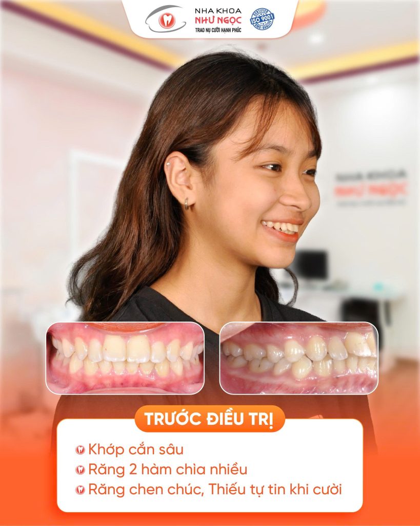 nha khoa Như Ngọc