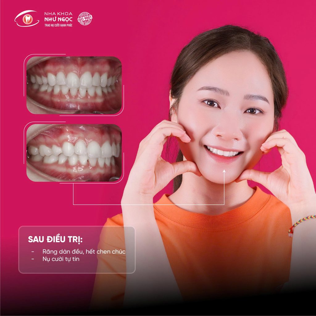 nha khoa Như Ngọc 