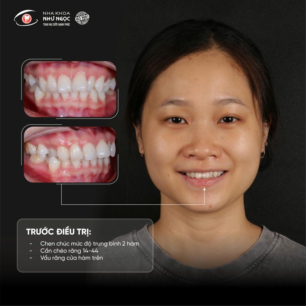 nha khoa Như Ngọc 