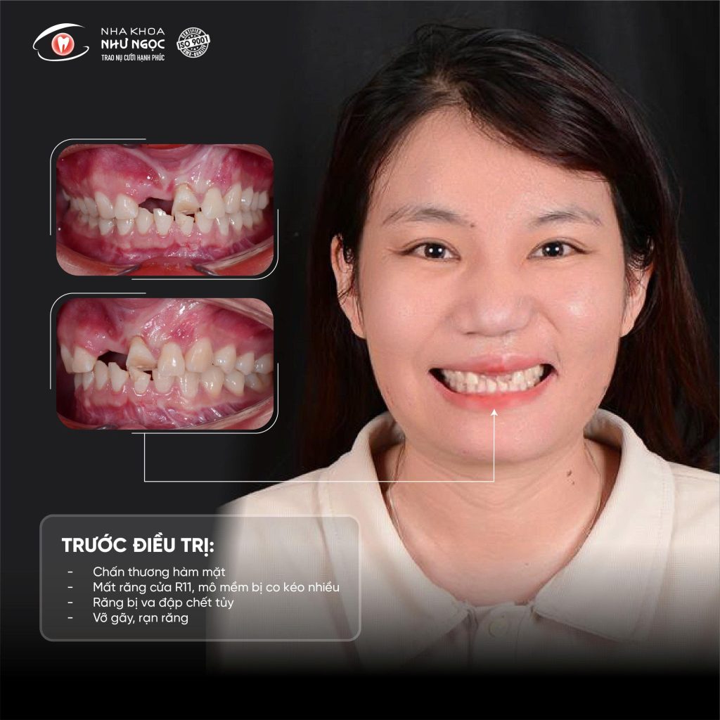 nha khoa Như Ngọc 