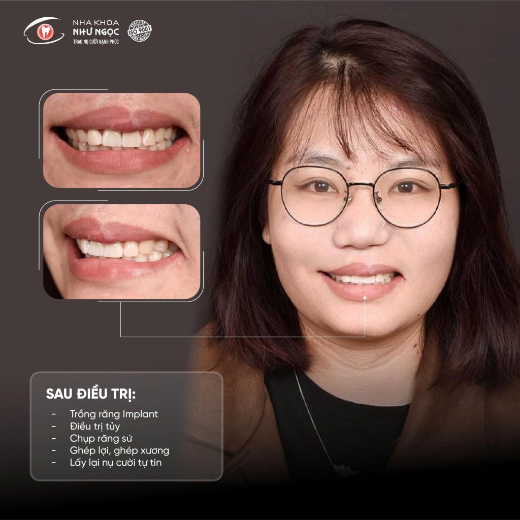 nha khoa Như Ngọc 