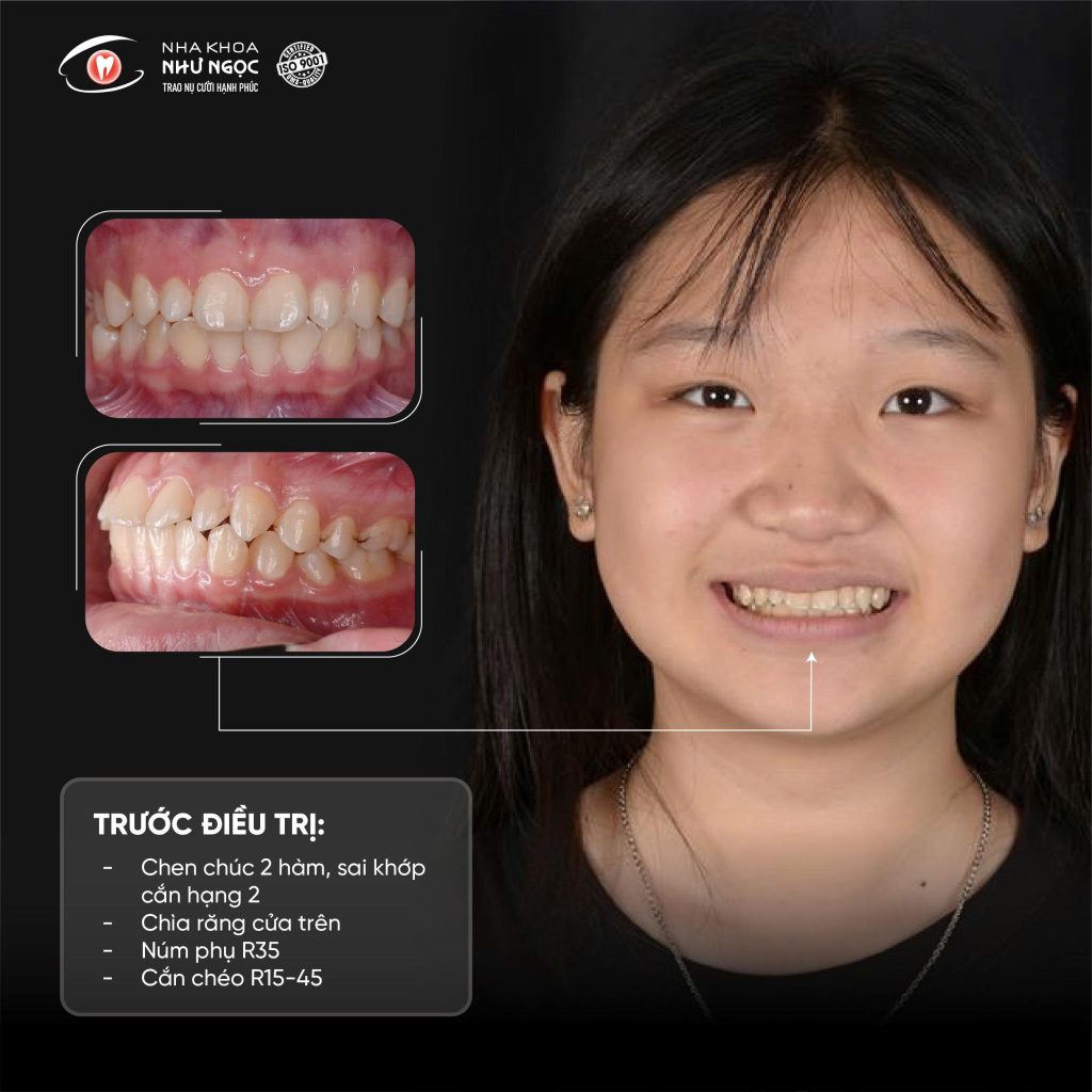 nha khoa Như Ngọc 