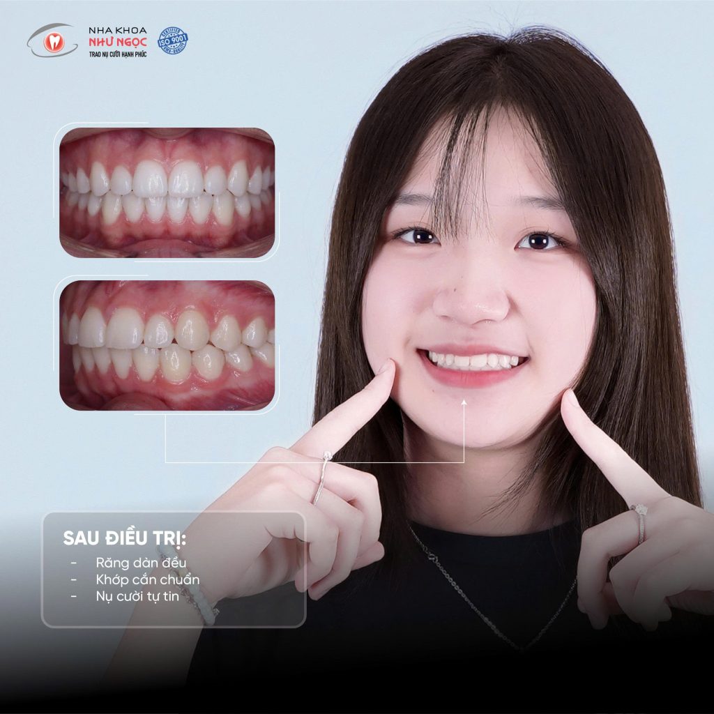 nha khoa Như Ngọc 