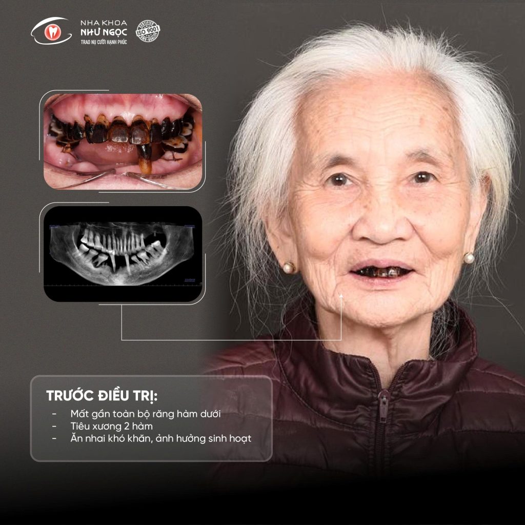 nha khoa Như Ngọc 