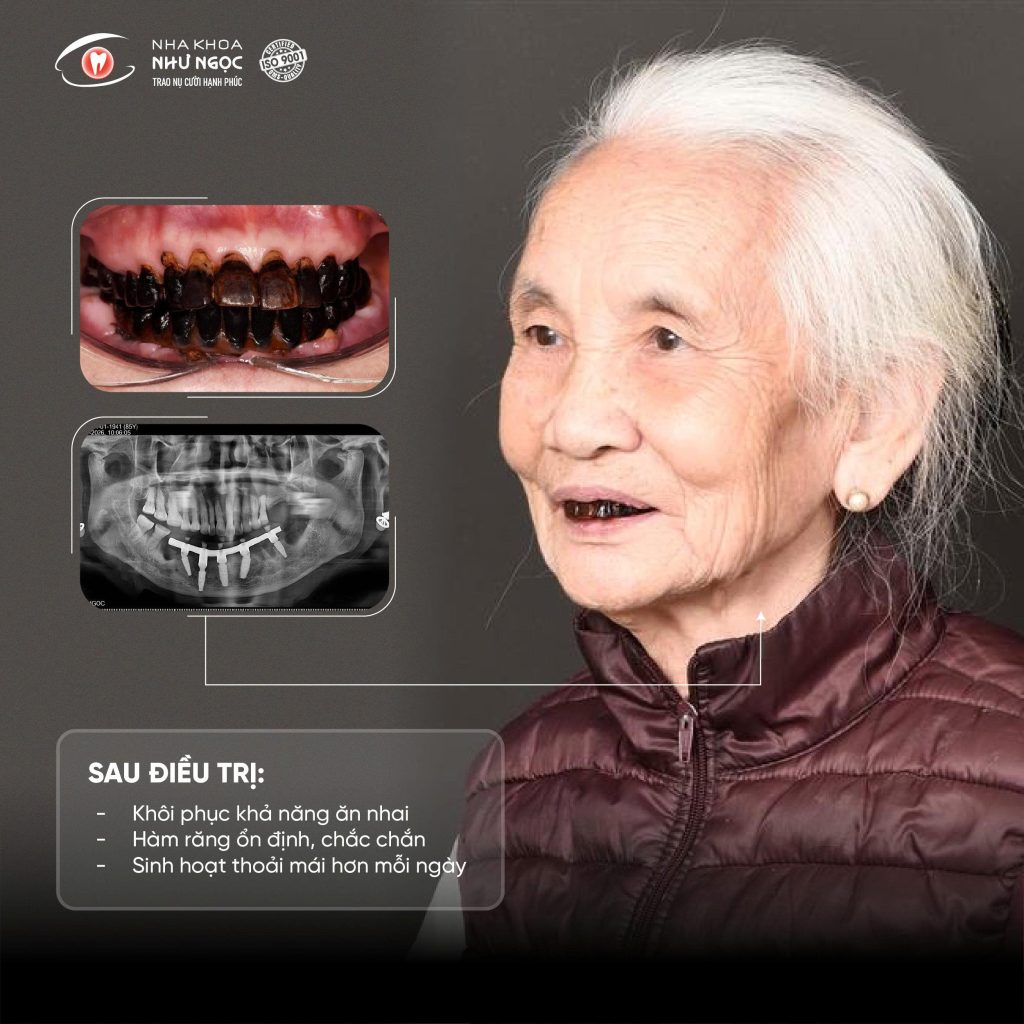 Nha khoa Như Ngọc 