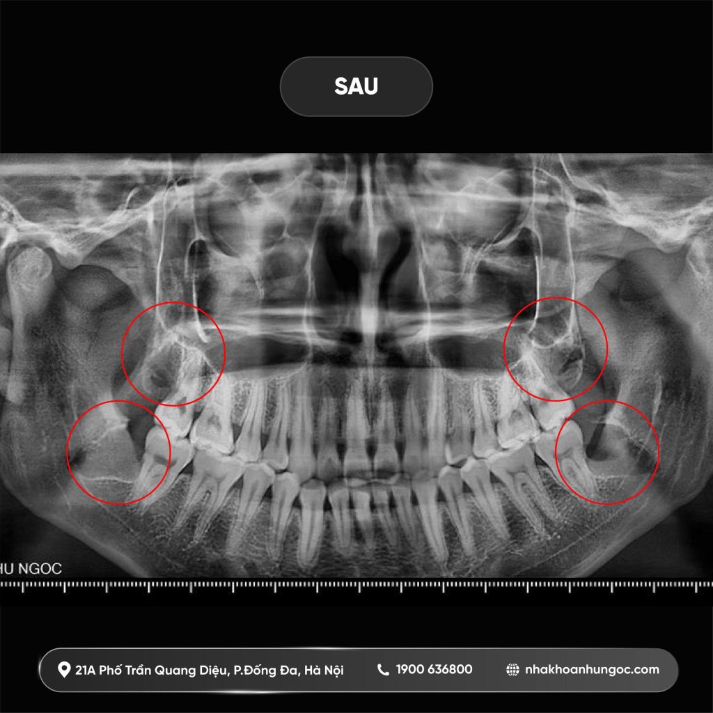 nha khoa như ngọc 