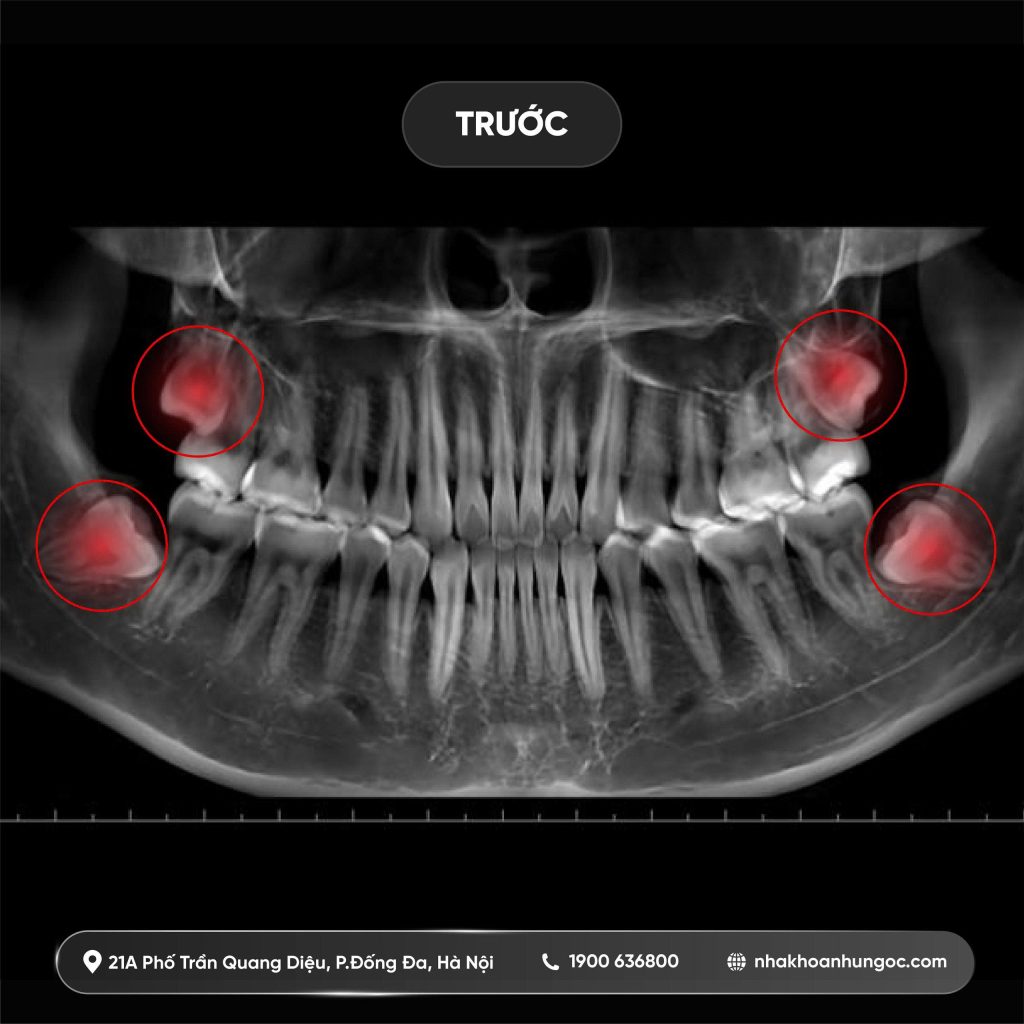 nha khoa Như Ngọc 