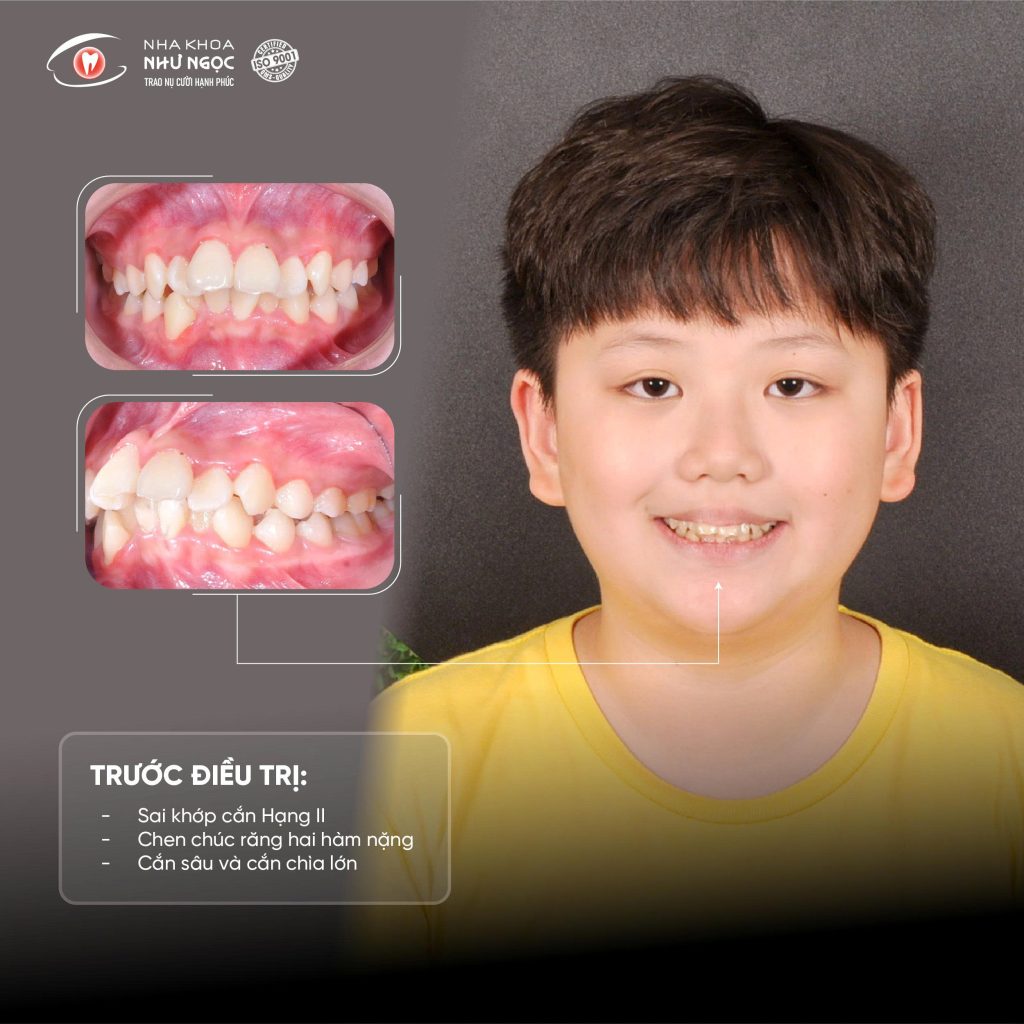 nha khoa Như Ngọc 