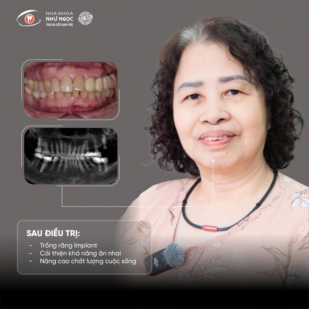 nha khoa Như Ngọc 
