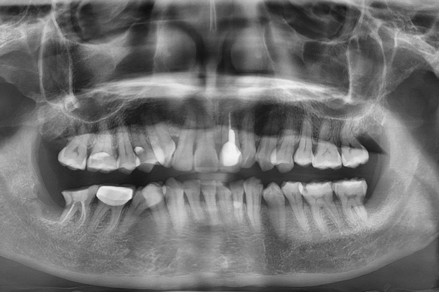 Digital X-ray imaging