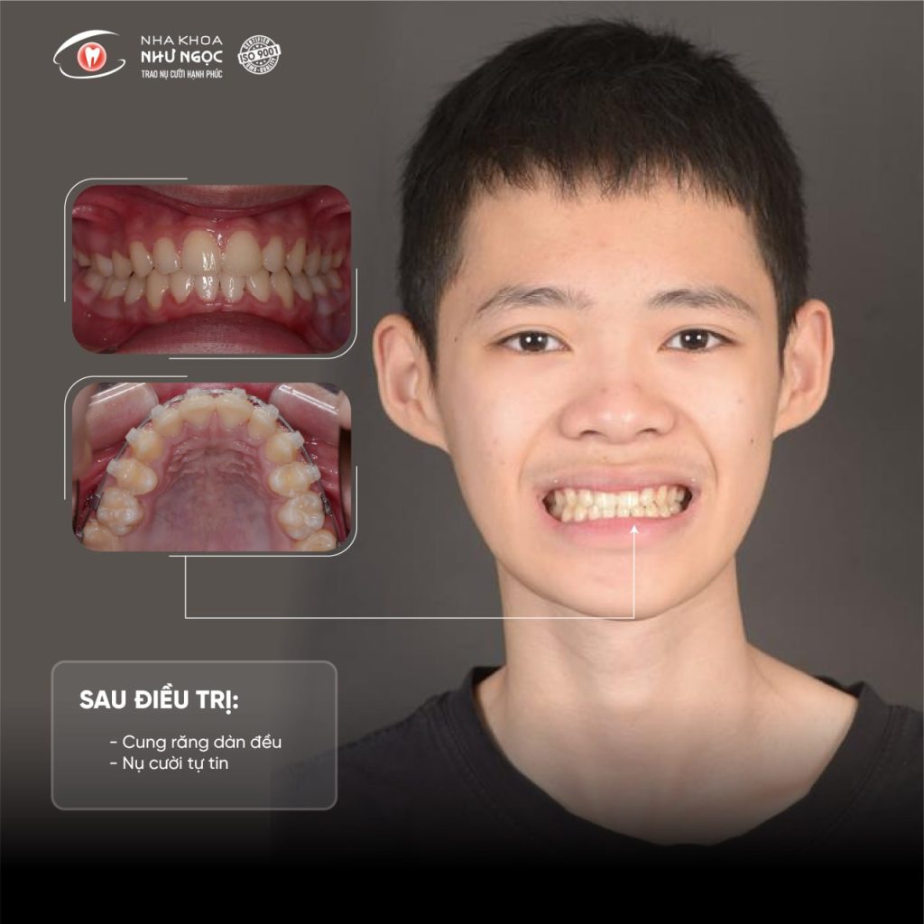 Nha khoa Như Ngọc 
