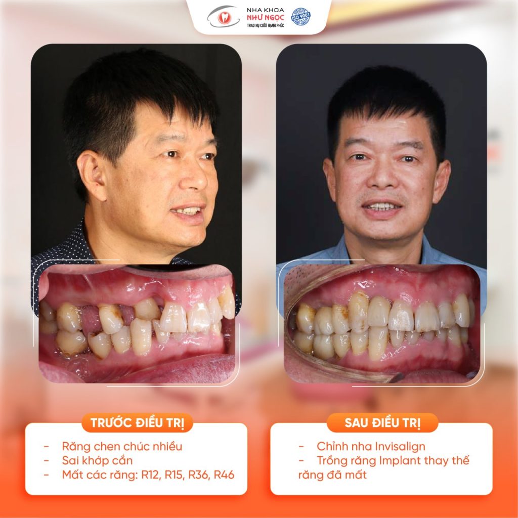 Nha khoa Như Ngọc
