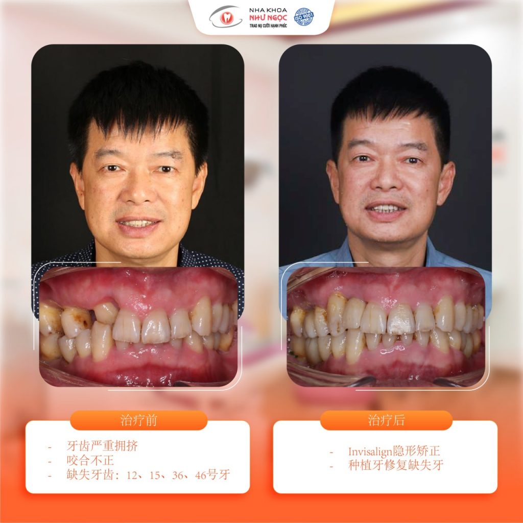 Nhu Ngoc Dental Clinic